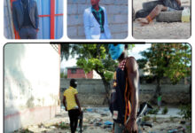Haïti/Criminalité : un jeune homme âgé de 21 ans, père d'un bébé de 3 mois, brûlé vif par des bandits à Cabaret 